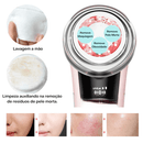 Aparelho de Lifting Facial Microfocado Reparador de Linhas de Expressão - Derma Lift + Máscara Facial Grátis